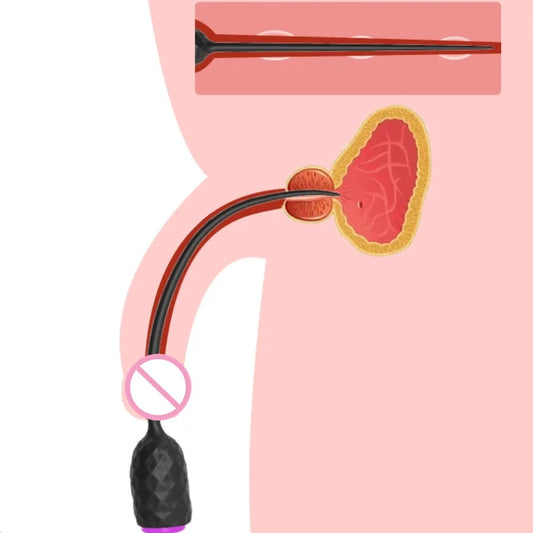 Electric Urethral Catheter Vibrator – Long Silicone Penis Plug for Prostate & Urethra Stimulation